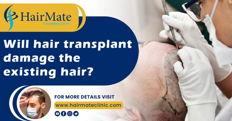 Will hair transplant damage the existing hair