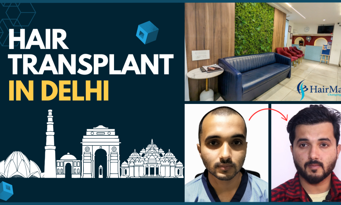 Hair Transplant Clinic in Delhi