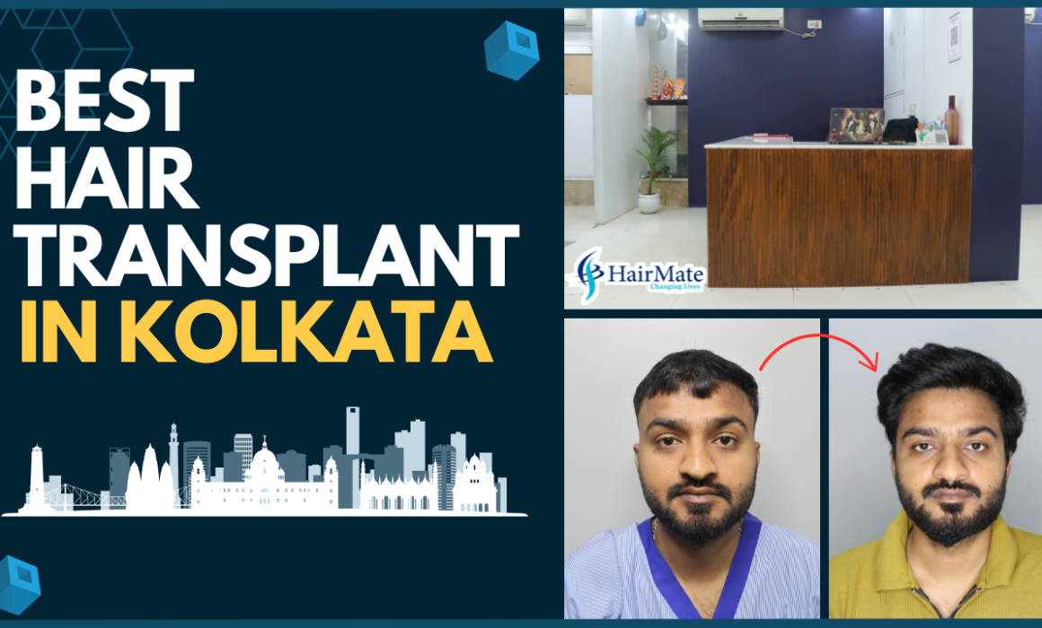 Best Hair Transplant In Kolkata