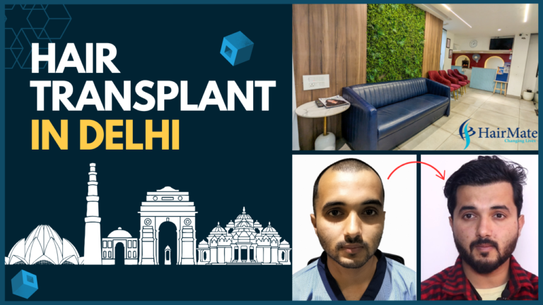 Hair Transplant Clinic in Delhi