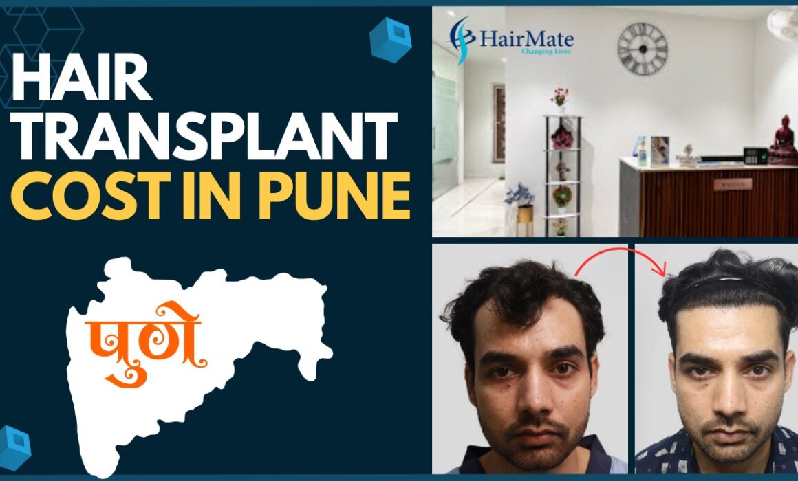 Hair Transplant Cost In Pune