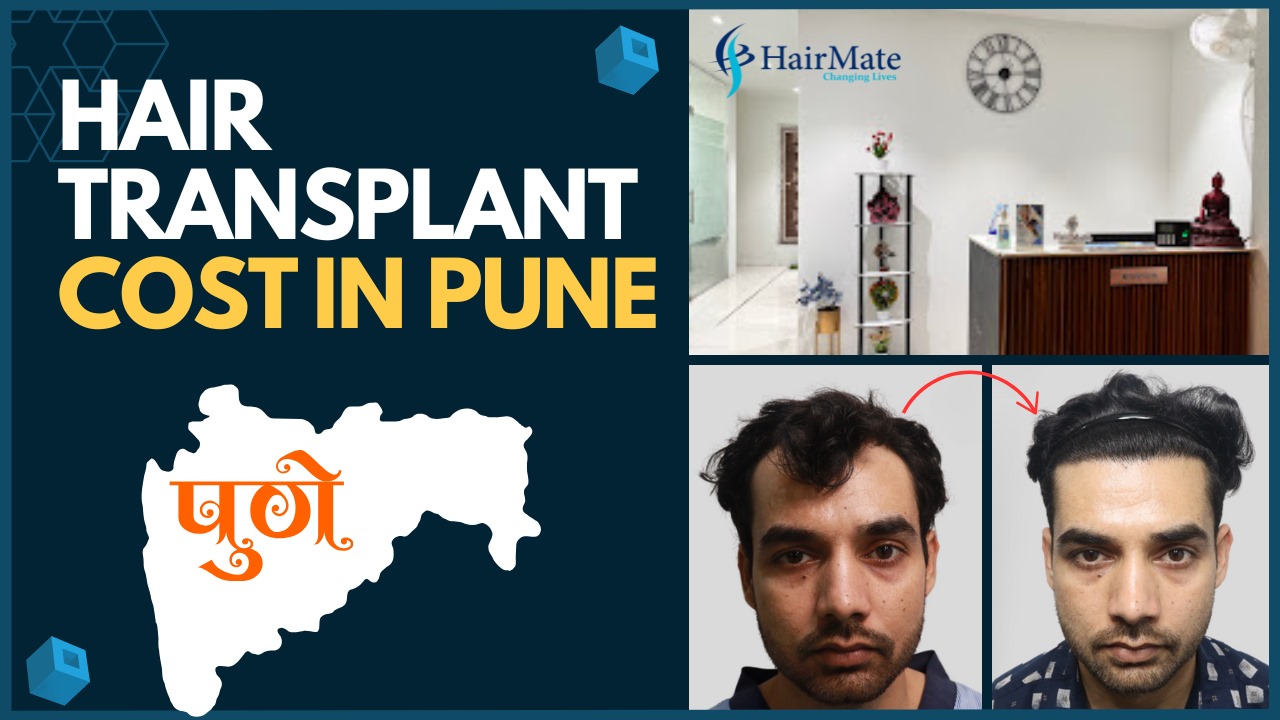 Hair Transplant Cost In Pune