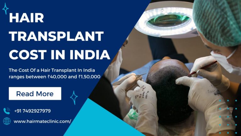 Hair Transplant Cost In India